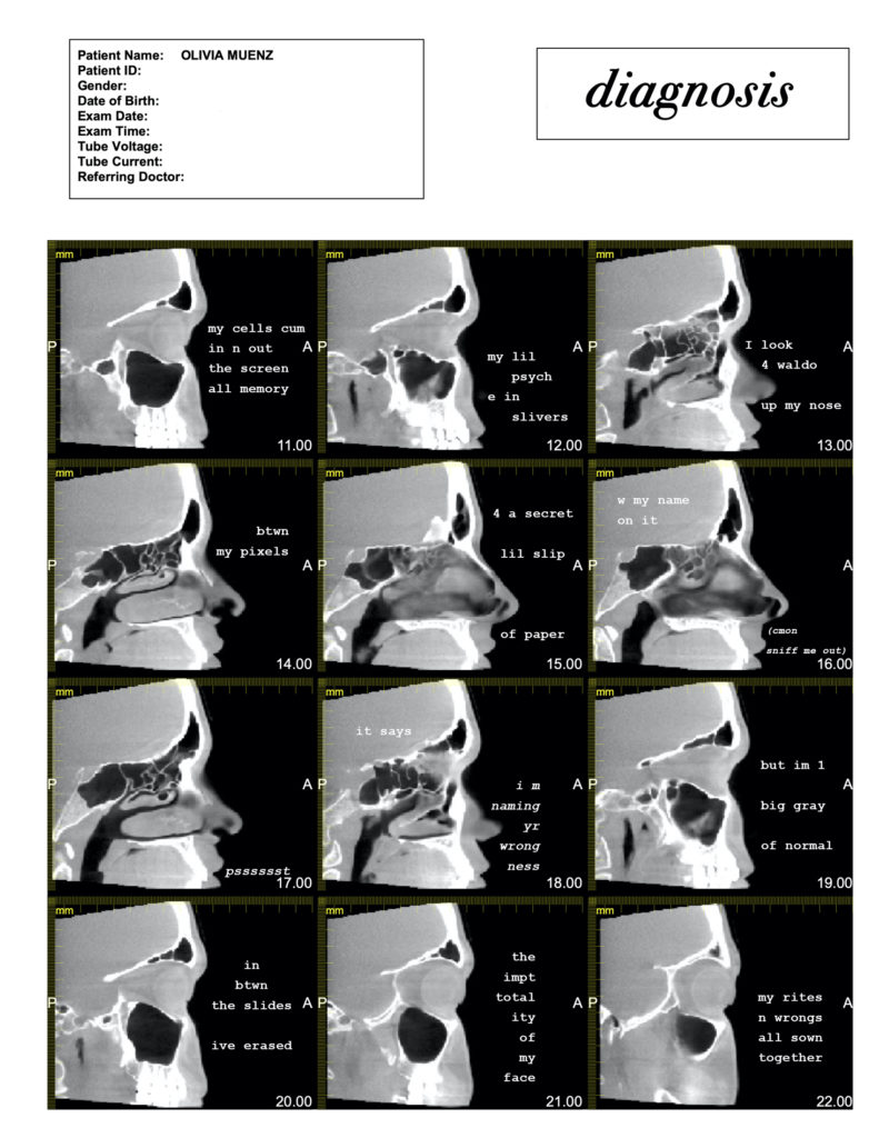 A 3x4 panel, black and white CT scan of a head. Each panel shows a segment of the head moving laterally and is overlaid with text: "my cells cum / in n out / the screen / all memory // my lil / psych / e in / slivers // I look / 4 waldo / up my nose // btwn / my pixels // 4 a secret / lil slip / of paper // w my name / on it / (cmon / sniff me out) // psssssst // i m / naming / yr / wrong / ness / but im 1 / big gray / of normal // in / btwn / the slides / ive erased // the / impt / total / ity / of / my / face // my rites / n wrongs / all sown / together". 